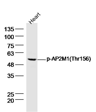 Mouse heart lysates probed with SMYD1 Polyclonal Antibody, Unconjugated (bs-12647R) at 1:300 dilution and 4˚C overnight incubation. Followed by conjugated secondary antibody incubation at 1:10000 for 60 min at 37˚C.