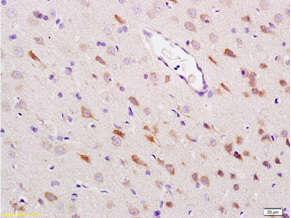 Formalin-fixed and paraffin embedded: rat brain tissue labeled with Anti-HSP-70 Polyclonal Antibody (bs-0126R), Unconjugated at 1:200 followed by conjugation to the secondary antibody and DAB staining.