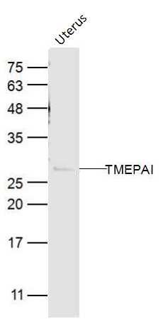 Mouse uterus lysates probed with TMEPAI Polyclonal Antibody, Unconjugated (bs-12668R) at 1:300 dilution and 4˚C overnight incubation. Followed by conjugated secondary antibody incubation at 1:10000 for 60 min at 37˚C.