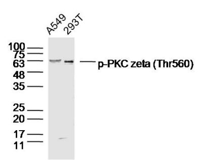 Lane 1: A549; Lane 2: 293T lysates probed with PKC zeta (Thr560) Polyclonal Antibody, Unconjugated (bs-12690R) at 1:300 dilution and 4˚C overnight incubation. Followed by conjugated secondary antibody incubation at 1:10000 for 60 min at 37˚C.