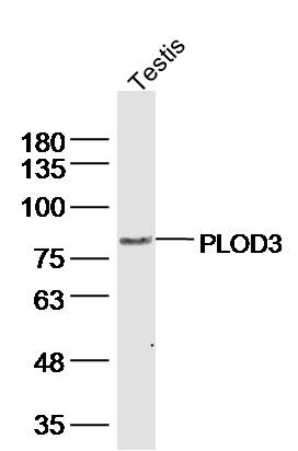 Mouse estis lysates probed with PLOD3 Polyclonal Antibody, Unconjugated (bs-12732R) at 1:300 dilution and 4˚C overnight incubation. Followed by conjugated secondary antibody incubation at 1:10000 for 60 min at 37˚C.