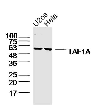 Lane 1: u2os lysates; Lane 2: hela lysates probed with TAF1A Polyclonal Antibody, Unconjugated (bs-12894R) at 1:300 dilution and 4˚C overnight incubation. Followed by conjugated secondary antibody incubation at 1:10000 for 60 min at 37˚C.