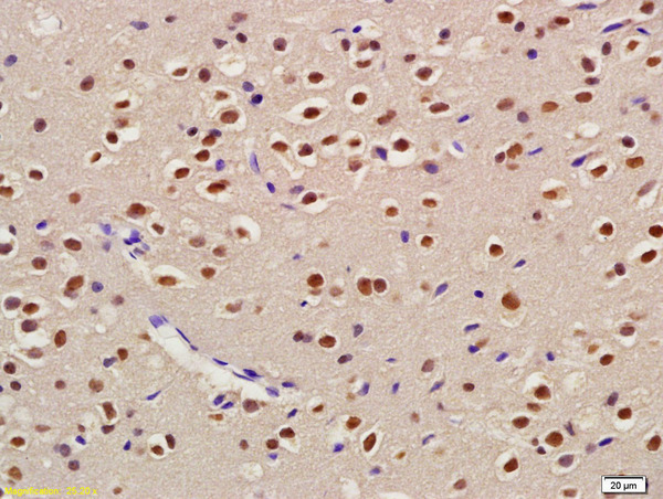 Formalin-fixed and paraffin embedded rat brain labeled with Anti-USP22 Polyclonal Antibody, Unconjugated (bs-8611R) at 1:200 followed by conjugation to the secondary antibody and DAB staining.
