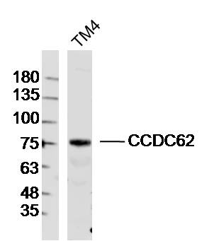 TM4 lysates probed with CCDC62 Polyclonal Antibody, Unconjugated (bs-13807R) at 1:300 dilution and 4˚C overnight incubation. Followed by conjugated secondary antibody incubation at 1:10000 for 60 min at 37˚C.