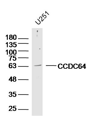 U251 lysates probed with CCDC64 Polyclonal Antibody, Unconjugated (bs-13808R) at 1:300 dilution and 4˚C overnight incubation. Followed by conjugated secondary antibody incubation at 1:10000 for 60 min at 37˚C.