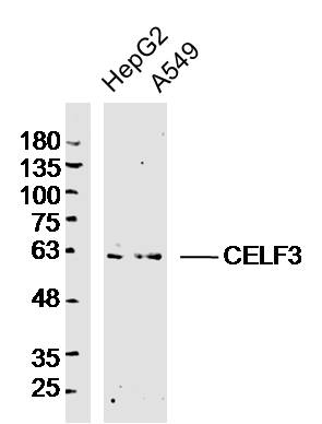 Lane 1: Hepg2 lysates; Lane 2: A549 lysates probed with CELF3 Polyclonal Antibody, Unconjugated (bs-13830R) at 1:300 dilution and 4˚C overnight incubation. Followed by conjugated secondary antibody incubation at 1:10000 for 60 min at 37˚C.