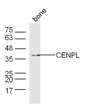 Mouse bone lysates probed with CENPL Polyclonal Antibody, Unconjugated (bs-13836R) at 1:300 dilution and 4˚C overnight incubation. Followed by conjugated secondary antibody incubation at 1:10000 for 60 min at 37˚C.