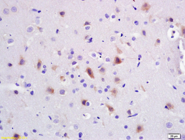 Formalin-fixed and paraffin embedded rat brain labeled with Anti-PI3K\/PI3 kinase p85 alpha subunit Polyclonal Antibody, Unconjugated (bs-0128R) at 1:200 followed by conjugation to the secondary antibody and DAB staining.