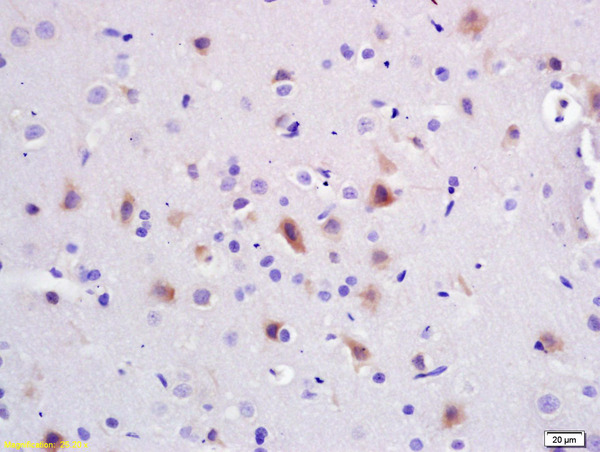 Formalin-fixed and paraffin embedded rat brain labeled with Anti-PI3K/PI3 kinase p85 alpha subunit Polyclonal Antibody, Unconjugated (bs-0128R) at 1:200 followed by conjugation to the secondary antibody and DAB staining.