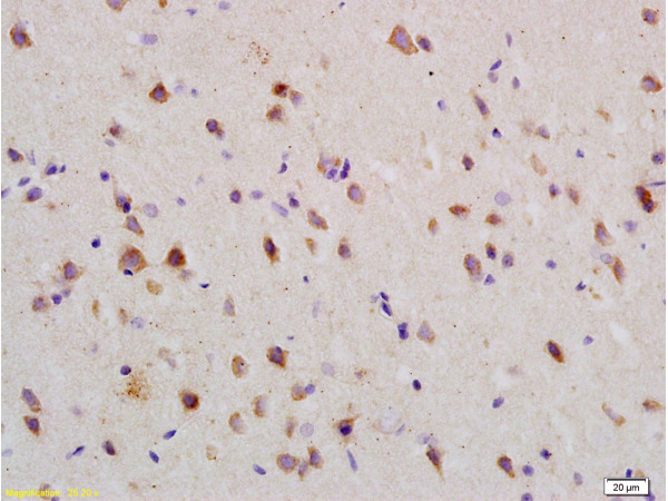 Formalin-fixed and paraffin embedded: rat brain tissue labeled with Anti-Nogo-R Polyclonal Antibody (bs-0129R), Unconjugated at 1:200 followed by conjugation to the secondary antibody and DAB staining