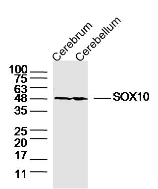 Lane 1: Mouse Cerebrum lysates; Lane 2: Mouse Cerebellum lysates probed with SOX10 Polyclonal Antibody, Unconjugated (bs-20563R) at 1:300 dilution and 4˚C overnight incubation. Followed by conjugated secondary antibody incubation at 1:10000 for 60 min at 37˚C.