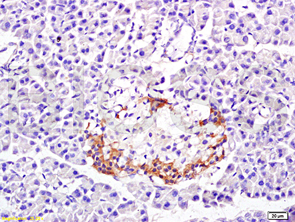 Formalin-fixed and paraffin embedded: rat pancreas tissue labeled with Anti-PP-1B Polyclonal Antibody (bs-0133M), Unconjugated at 1:300 followed by conjugation to the secondary antibody and DAB staining