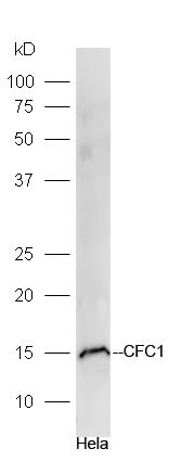 Hela lysates probed with CFC1 Polyclonal Antibody, Unconjugated (bs-13873R) at 1:300 dilution and 4˚C overnight incubation. Followed by conjugated secondary antibody incubation at 1:10000 for 60 min at 37˚C.