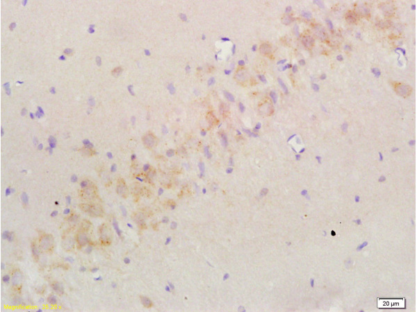 Formalin-fixed and paraffin embedded: rat brain tissue labeled with Anti-Nogo-A Polyclonal Antibody (bs-0134R), Unconjugated at 1:200 followed by conjugation to the secondary antibody and DAB staining