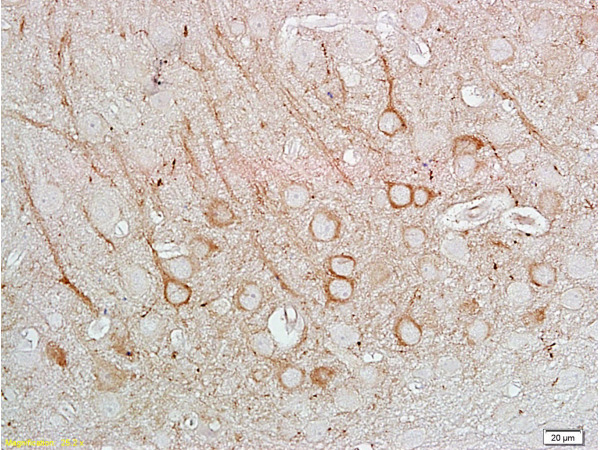 Formalin-fixed and paraffin embedded: rat brain tissue labeled with Anti-Nos-1 Polyclonal Antibody, Unconjugated (bs-0156R) at 1:400followed by conjugation to the secondary antibody and DAB staining.