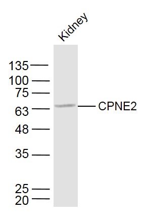 Mouse kidney lysates probed with CPNE2 Polyclonal Antibody, Unconjugated (bs-14025R) at 1:300 dilution and 4˚C overnight incubation. Followed by conjugated secondary antibody incubation at 1:10000 for 60 min at 37˚C.