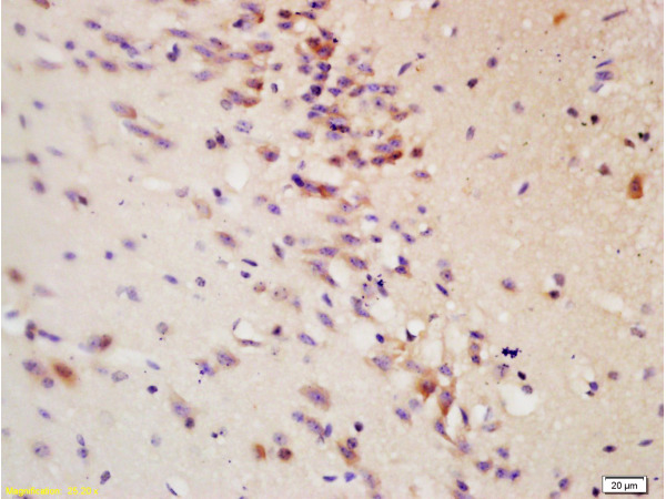 Formalin-fixed and paraffin embedded: rat brain tissue labeled with Anti-Tau protein Polyclonal Antibody (bs-0157R), Unconjugated at 1:200 followed by conjugation to the secondary antibody and DAB staining