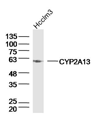 Hcclm3 lysates probed with CYP2A13 Polyclonal Antibody, Unconjugated (bs-14148R) at 1:300 dilution and 4˚C overnight incubation. Followed by conjugated secondary antibody incubation at 1:10000 for 60 min at 37˚C.