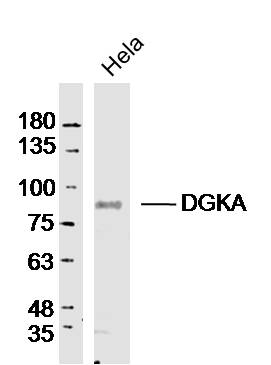 Hela lysates probed with DGKA Polyclonal Antibody, Unconjugated (bs-14294R) at 1:300 dilution and 4˚C overnight incubation. Followed by conjugated secondary antibody incubation at 1:10000 for 60 min at 37˚C.