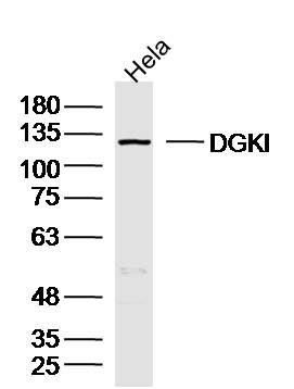 Hela lysates probed with DGKI Polyclonal Antibody, Unconjugated (bs-14299R) at 1:300 dilution and 4˚C overnight incubation. Followed by conjugated secondary antibody incubation at 1:10000 for 60 min at 37˚C.