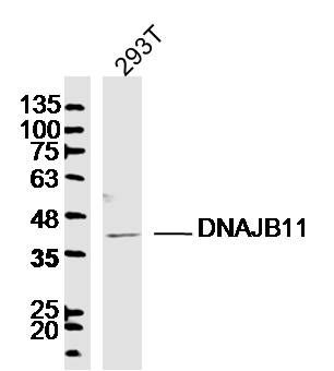 293T lysates probed with DNAJB11 Polyclonal Antibody, Unconjugated (bs-14369R) at 1:300 dilution and 4˚C overnight incubation. Followed by conjugated secondary antibody incubation at 1:10000 for 60 min at 37˚C.