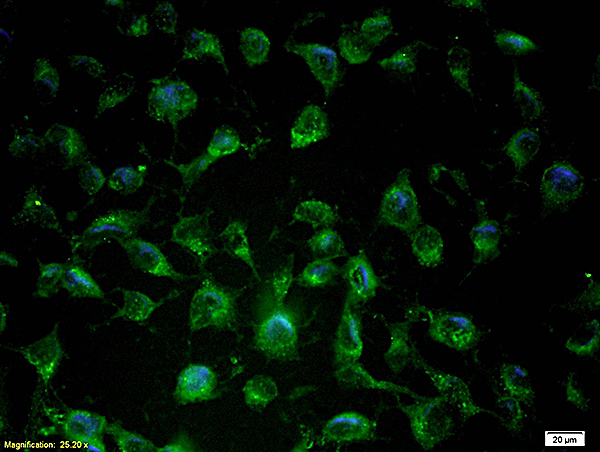 Cultured endothelial cells labeled with Anti-Nos-3/ENOSPolyclonal Antibody (bs-0163R), Unconjugated, followed by conjugation to the secondary antibody Goat Anti-Rabbit IgG,FITC conjugated (bs-0295G-FITC) at 1:200 dilution for 40 min.