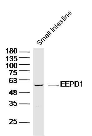 Mouse small intestine lysates probed with EEPD1 Polyclonal Antibody, Unconjugated (bs-14506R) at 1:300 dilution and 4˚C overnight incubation. Followed by conjugated secondary antibody incubation at 1:10000 for 60 min at 37˚C.