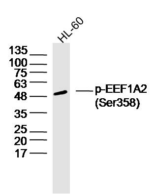 HL60 lysates probed with EEF1A2 (Ser358) Polyclonal Antibody, Unconjugated (bs-14508R) at 1:300 dilution and 4˚C overnight incubation. Followed by conjugated secondary antibody incubation at 1:10000 for 60 min at 37˚C.