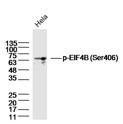 HeLa lysates probed with EIF4B (Ser406) Polyclonal Antibody, Unconjugated (bs-14551R) at 1:300 dilution and 4˚C overnight incubation. Followed by conjugated secondary antibody incubation at 1:10000 for 60 min at 37˚C.