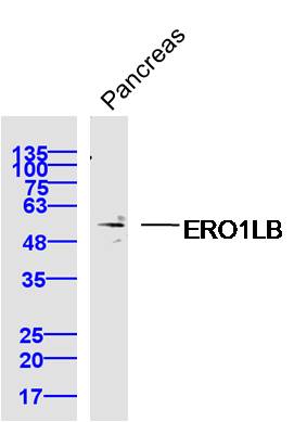 Mouse pancreas lysates probed with ERO1LB Polyclonal Antibody, Unconjugated (bs-14627R) at 1:300 dilution and 4˚C overnight incubation. Followed by conjugated secondary antibody incubation at 1:10000 for 60 min at 37˚C.