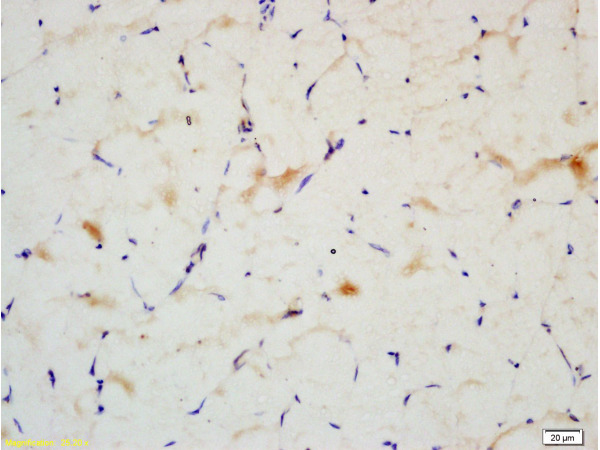 Formalin-fixed and paraffin embedded: rat skeletal muscle labeled with Anti-IRS2 Polyclonal Antibody (bs-0173R), Unconjugated at 1:200followed by conjugation to the secondary antibody and DAB staining