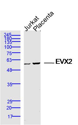 Lane 1: jurkat lysates; Lane 2: mouse placenta lysates probed with EVX2 Polyclonal Antibody, Unconjugated (bs-14653R) at 1:300 dilution and 4˚C overnight incubation. Followed by conjugated secondary antibody incubation at 1:10000 for 60 min at 37˚C.