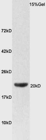 Rat lung lysates probed with FAM210B Polyclonal Antibody, Unconjugated (bs-14887R) at 1:300 dilution and 4˚C overnight incubation. Followed by conjugated secondary antibody incubation at 1:10000 for 60 min at 37˚C.