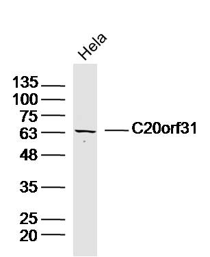 Hela lysates probed with C20orf31 Polyclonal Antibody, Unconjugated (bs-15110R) at 1:300 dilution and 4˚C overnight incubation. Followed by conjugated secondary antibody incubation at 1:10000 for 60 min at 37˚C.