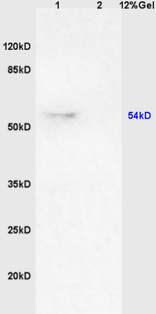 Lane 1: rat brain lysates Lane 2: human colon carcinoma lysates probed with Anti GPS1/CSN1 Polyclonal Antibody, Unconjugated (bs-9126R) at 1:200 in 4C. Followed by conjugation to secondary antibody (bs-0295G-HRP) at 1:3000 90min in 37C. Predicted band 54kD. Observed band size: 54kD.