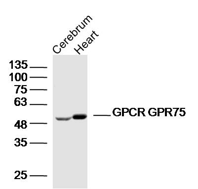 Lane 1: Mouse cerebrum lysates; Lane 2: mouse heart lysates probed with GPCR GPR75 Polyclonal Antibody, Unconjugated (bs-16263R) at 1:300 dilution and 4˚C overnight incubation. Followed by conjugated secondary antibody incubation at 1:10000 for 60 min at 37˚C.