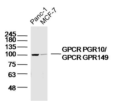 Lane 1: panc-1 lysates; Lane 2: MCF-7 lysates probed with GPCR PGR10/GPCR GPR149 Polyclonal Antibody, Unconjugated (bs-16271R) at 1:300 dilution and 4˚C overnight incubation. Followed by conjugated secondary antibody incubation at 1:10000 for 60 min at 37˚C.