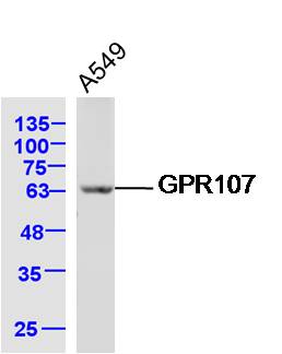 A549 lysates probed with GPR107 Polyclonal Antibody, Unconjugated (bs-16284R) at 1:300 dilution and 4˚C overnight incubation. Followed by conjugated secondary antibody incubation at 1:10000 for 60 min at 37˚C.