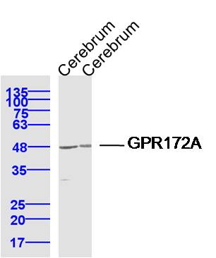 Lane 1: Cerebrum lysates; Lane 2: Cerebrum lysates probed with GPR172A Polyclonal Antibody, Unconjugated (bs-16293R) at 1:300 dilution and 4˚C overnight incubation. Followed by conjugated secondary antibody incubation at 1:10000 for 60 min at 37˚C.