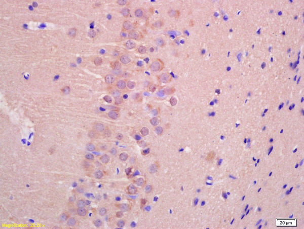 Formalin-fixed and paraffin embedded rat brain labeled with Anti-TTC33 Polyclonal Antibody, Unconjugated (bs-9146R) at 1:200 followed by conjugation to the secondary antibody and DAB staining.