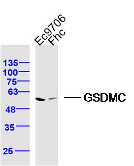 Lane 1: Ec9706 lysates; Lane 2: FHC lysates probed with GSDMC Polyclonal Antibody, Unconjugated (bs-16332R) at 1:300 dilution and 4˚C overnight incubation. Followed by conjugated secondary antibody incubation at 1:10000 for 60 min at 37˚C.