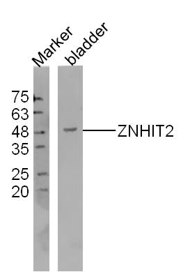 Mouse bladder lysates probed with ZNHIT2 Polyclonal Antibody, Unconjugated (bs-16415R) at 1:300 dilution and 4˚C overnight incubation. Followed by conjugated secondary antibody incubation at 1:10000 for 60 min at 37˚C.