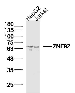 Lane 1: Hepg2 lysates; Lane 2: Jurkat lysates probed with ZNF92 Polyclonal Antibody, Unconjugated (bs-16429R) at 1:300 dilution and 4˚C overnight incubation. Followed by conjugated secondary antibody incubation at 1:10000 for 60 min at 37˚C.