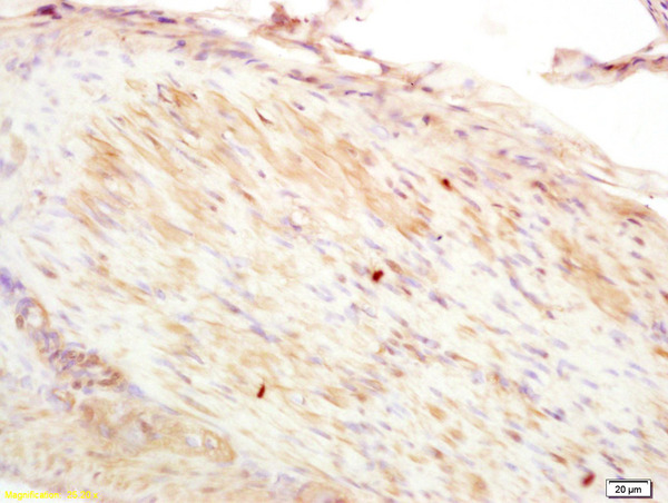 Formalin-fixed and paraffin embedded rat stomach muscle labeled with Anti-CNN2 Polyclonal Antibody, Unconjugated (bs-9475R) at 1:200 followed by conjugation to the secondary antibody and DAB staining.