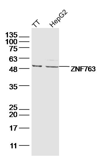 Lane 1: TT lysates; Lane 2: hepg2 lysates probed with ZNF763 Polyclonal Antibody, Unconjugated (bs-16490R) at 1:300 dilution and 4˚C overnight incubation. Followed by conjugated secondary antibody incubation at 1:10000 for 60 min at 37˚C.