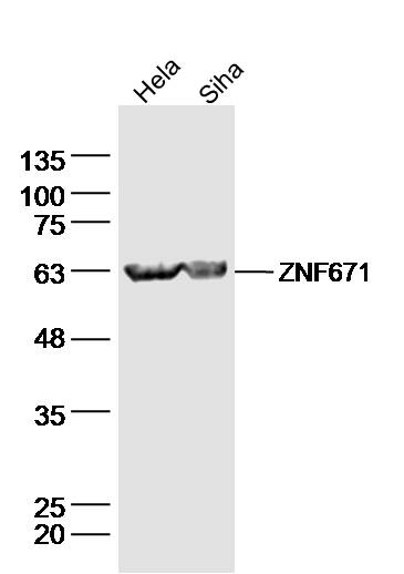 Lane 1: Hela lysates; Lane 2: Siha lysates probed with ZNF671 Polyclonal Antibody, Unconjugated (bs-16522R) at 1:300 dilution and 4˚C overnight incubation. Followed by conjugated secondary antibody incubation at 1:10000 for 60 min at 37˚C.