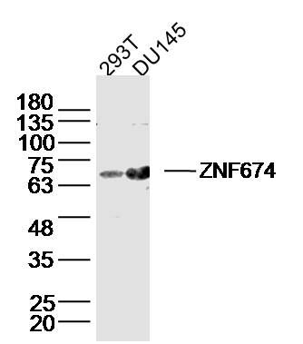 Lane 1: 293T lysates; Lane 2: DU145 lysates probed with ZNF674 Polyclonal Antibody, Unconjugated (bs-16524R) at 1:300 dilution and 4˚C overnight incubation. Followed by conjugated secondary antibody incubation at 1:10000 for 60 min at 37˚C.