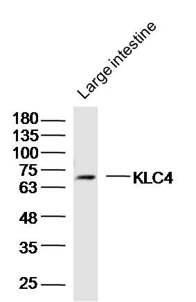 Mouse large intestine lysates probed with KLC4 Polyclonal Antibody, Unconjugated (bs-16752R) at 1:300 dilution and 4˚C overnight incubation. Followed by conjugated secondary antibody incubation at 1:10000 for 60 min at 37˚C.