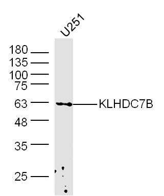 U251 lysates probed with KLHDC7B Polyclonal Antibody, Unconjugated (bs-16761R) at 1:300 dilution and 4˚C overnight incubation. Followed by conjugated secondary antibody incubation at 1:10000 for 60 min at 37˚C.