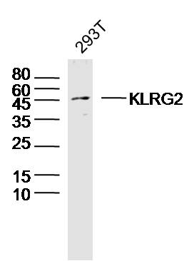 293T lysates probed with KLRG2 Polyclonal Antibody, Unconjugated (bs-16787R) at 1:300 dilution and 4˚C overnight incubation. Followed by conjugated secondary antibody incubation at 1:10000 for 60 min at 37˚C.